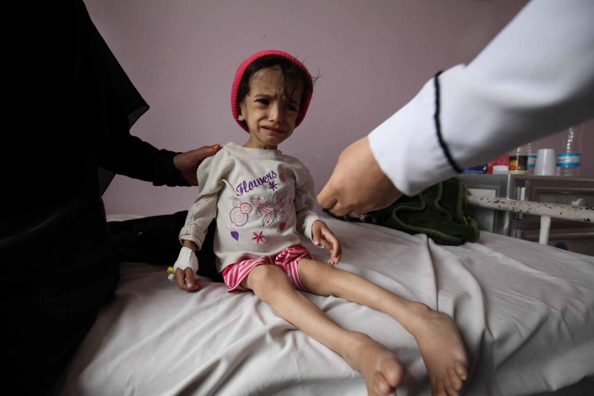 On 30 July 2015, Ali Hanadi Hussein, 2 years and 8 months old, and weighs a paltry 7 kilograms. She is malnourished, weak and can’t walk. She is admitted at Sabeen hospital in Yemen’s capital, Sana’a for treatment. Ali Hanadi Hussein is 2 years and 8 months old, and weighs a paltry 7 kilograms now. She is malnourished, weak and can’t walk. Her mother says since the war escalated the family mainly survived on bread whenever they find it. Hanadi and her three siblings started to become frail. Then Hanadi got diarhoea and started vomiting. Her father is permanently disabled due to an accident at work and her mother, only a housewife, couldn’t find any source of food. They survived on handouts from neighbours and charity groups. When Hanadi’s condition worsened, she decided to bring her to Sabeen hospital but left the other three older children in the village with their father.
“It is already very hard for us especially with my husband’s condition, living on charity every day, now I’m here alone with my daughter while the country is on fire. Though at Al-Sabeen Hospital we have someone who can help her, I am worried about the children and family I left behind” – Hanadi’s mother said.